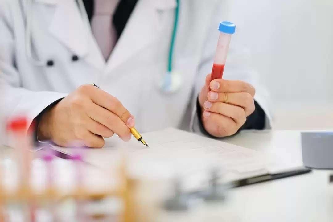 parazitler için kan testi