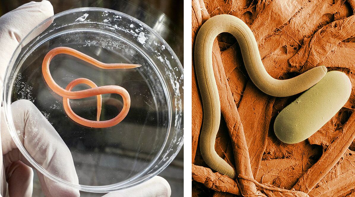 insan vücudundaki parazitler