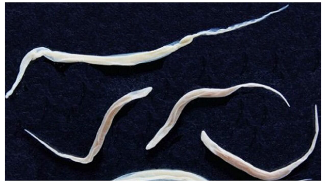 Pinworms, helmint grubuna ait yaygın parazitlerdir.