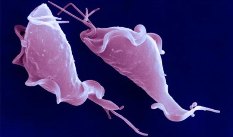 Trichomonas vajinalis kısırlığa neden olan tek hücreli bir parazittir.